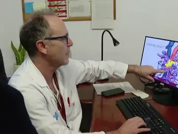 Extirpan un tipo de cáncer de páncreas considerado inoperable Extirpan un tipo de cáncer de páncreas considerado inoperable
