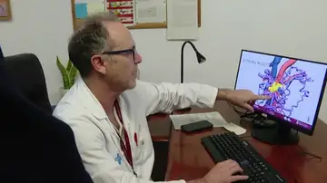 Extirpan un tipo de cáncer de páncreas considerado inoperable Extirpan un tipo de cáncer de páncreas considerado inoperable