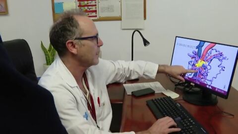 Hito en el Hospital de Bellvitge al extirpar un tipo de c&aacute;ncer de p&aacute;ncreas considerado inoperable