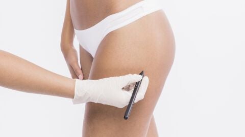 Mujer haciéndose un retoque estético en los glúteos