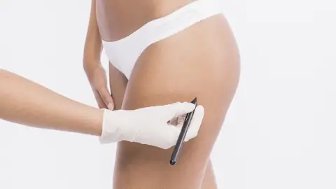 Mujer haciéndose un retoque estético en los glúteos Mujer haciéndose un retoque estético en los glúteos