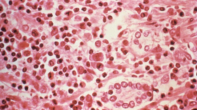 Imagen microsc&oacute;pica del hantavirus