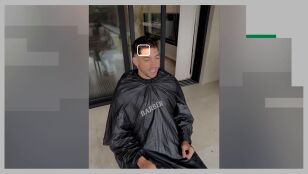 Primera imagen de la cicatriz de Valverde tras su pelea con Tchouam&eacute;ni