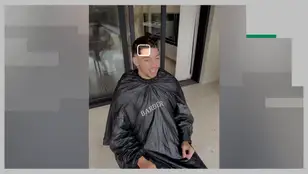Primera imagen de la cicatriz de Valverde tras su pelea con Tchouaméni