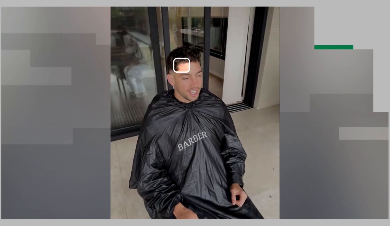 Primera imagen de la cicatriz de Valverde tras su pelea con Tchouam&eacute;ni