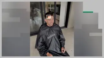 Primera imagen de la cicatriz de Valverde tras su pelea con Tchouaméni Primera imagen de la cicatriz de Valverde tras su pelea con Tchouaméni