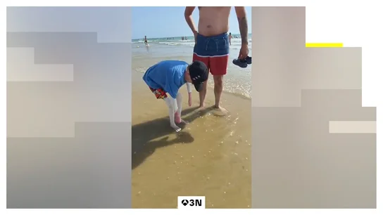 Los primeros contactos con el mar ya están mejorando algunas de sus heridas Los primeros contactos con el mar ya están mejorando algunas de sus heridas