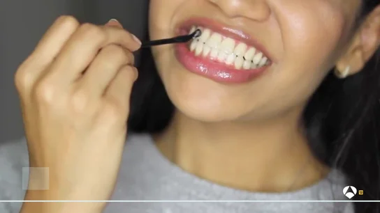 Los expertos avisan de los peligros de los tratamientos dentales virales en las redes Los expertos avisan de los peligros de los tratamientos dentales virales en las redes