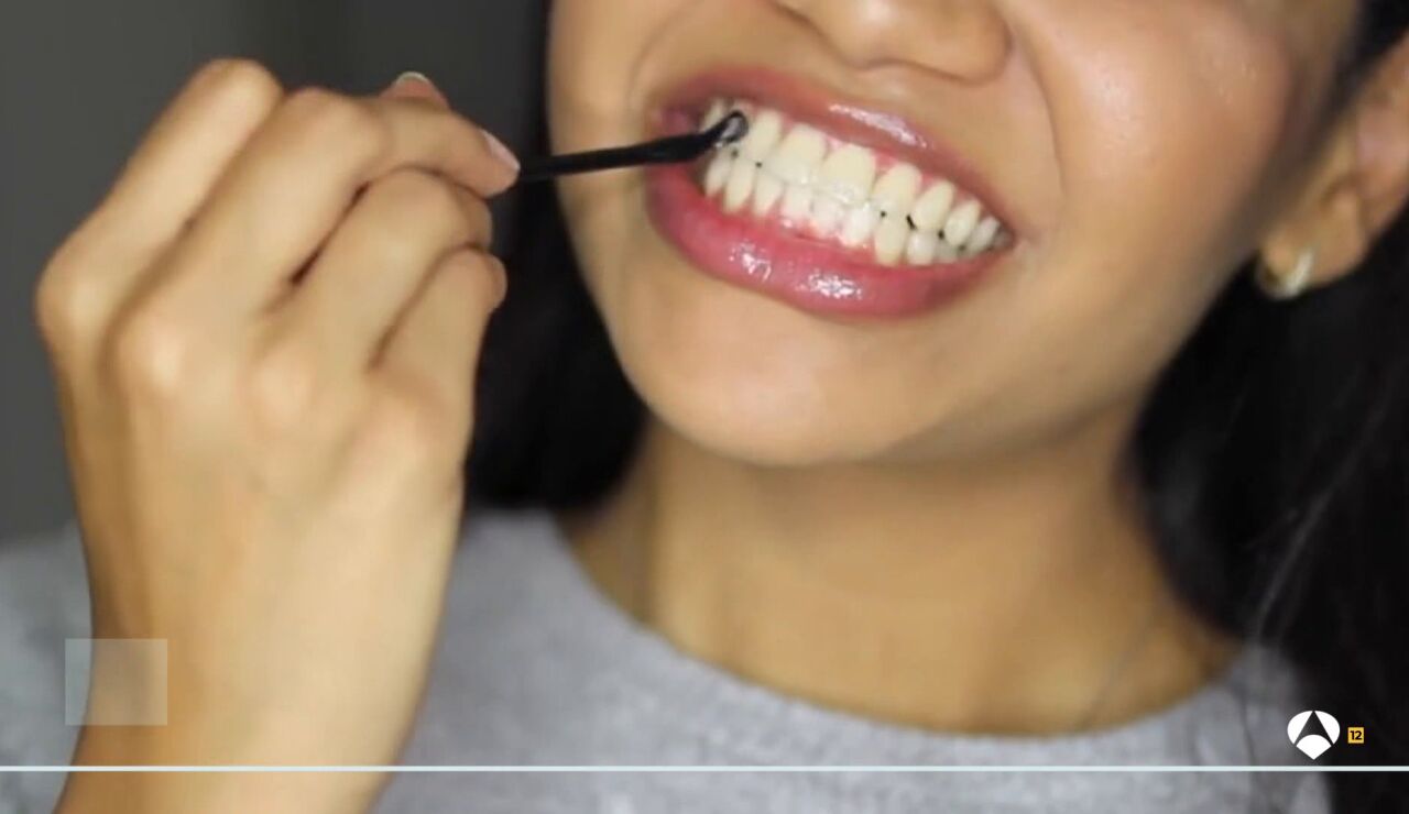 Los expertos avisan de los peligros de los tratamientos dentales virales en las redes