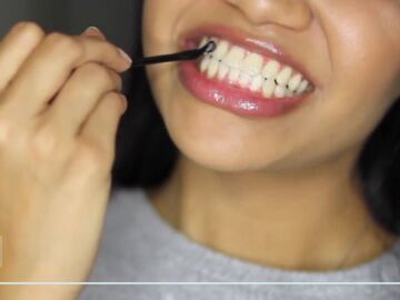 Los expertos avisan de los peligros de los tratamientos dentales virales en las redes