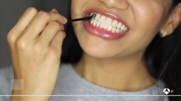 Los expertos avisan de los peligros de los tratamientos dentales virales en las redes