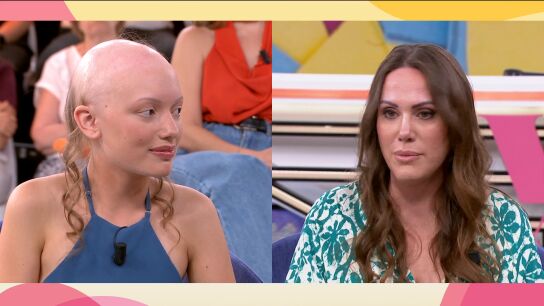 Alopecia