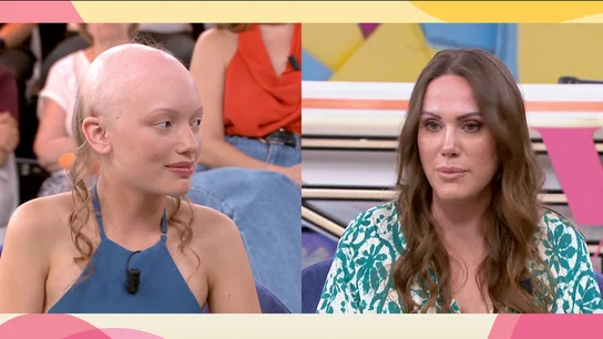 Alopecia Alopecia
