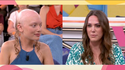 Alopecia