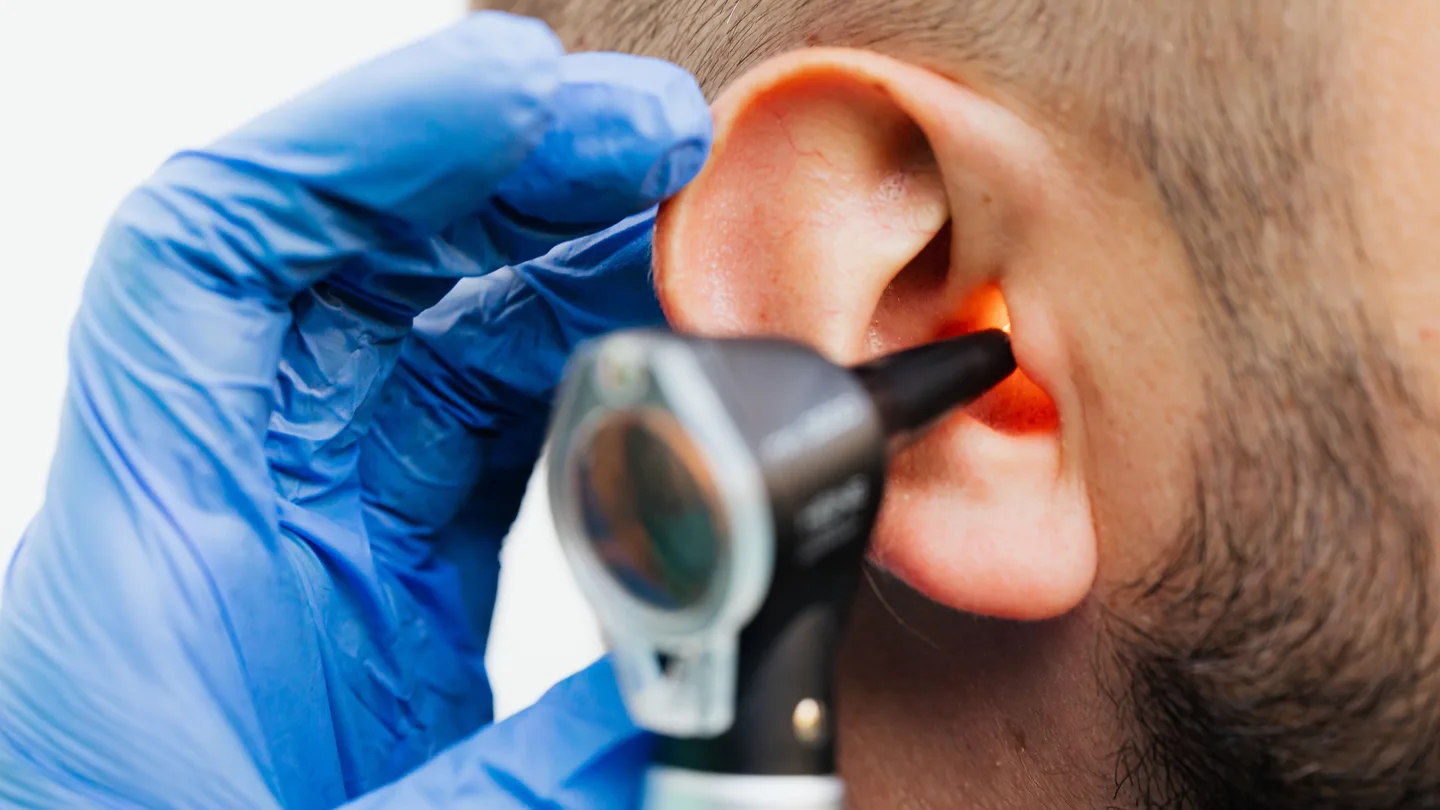 Imagen de un médico examinando el oído Imagen de un médico examinando el oído