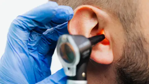 Imagen de un médico examinando el oído Imagen de un médico examinando el oído