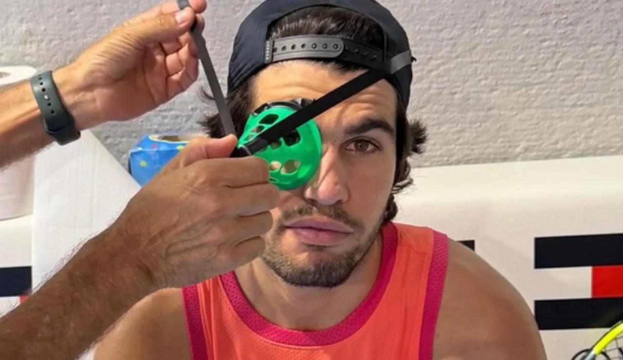 Alcaraz con un cono en su ojo derecho
