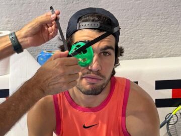 Alcaraz con un cono en su ojo derecho