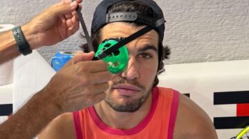 Alcaraz con un cono en su ojo derecho