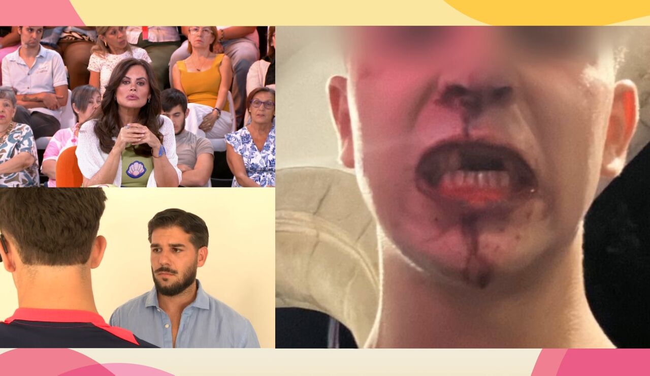 Brutal pelea