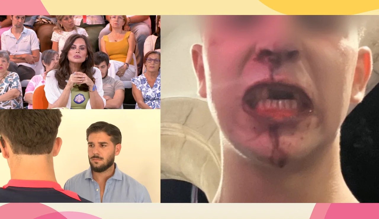 Brutal pelea