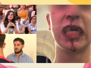 Brutal pelea