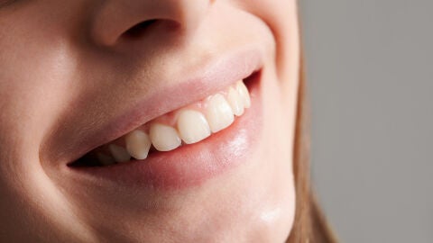 Sonrisa