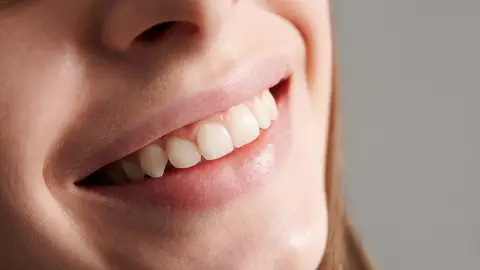 Sonrisa Sonrisa