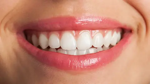Sonrisa Sonrisa