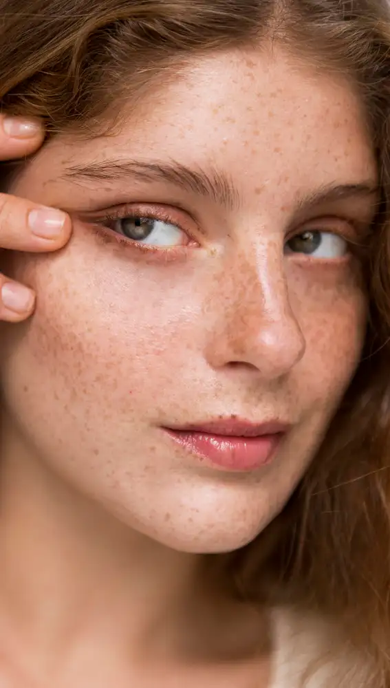 Mujer con pecas Mujer con pecas