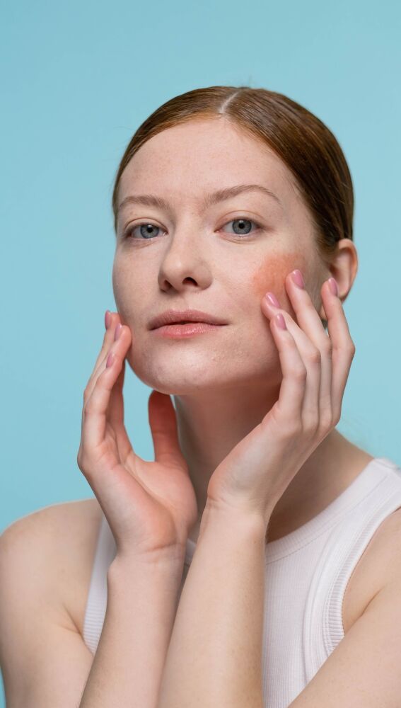 Mujer con irritación en el rostro