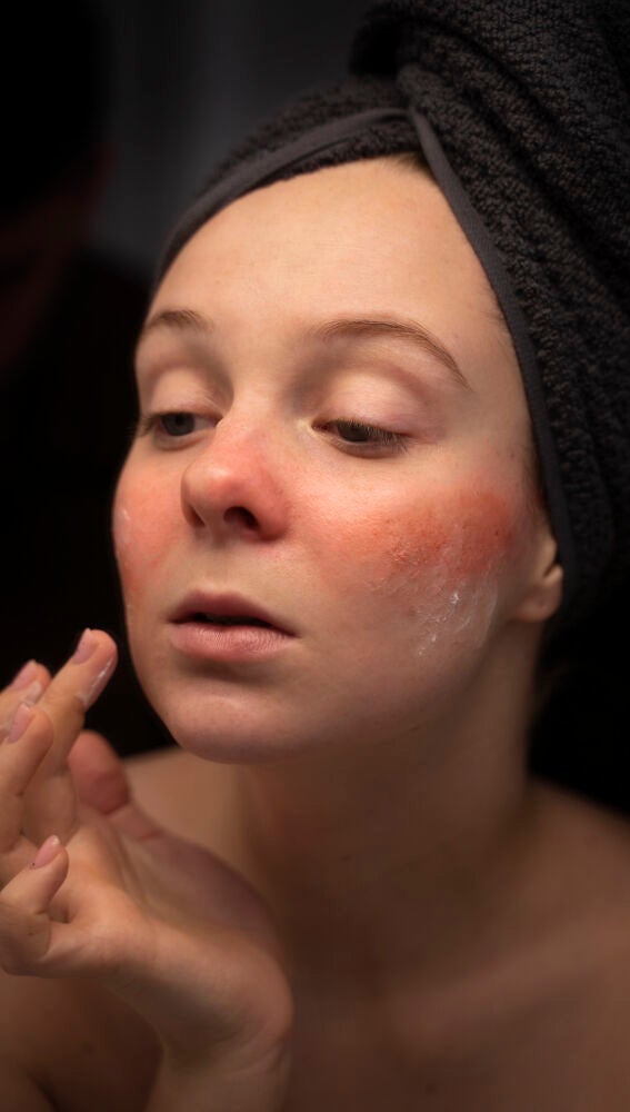 Mujer con irritación en el rostro