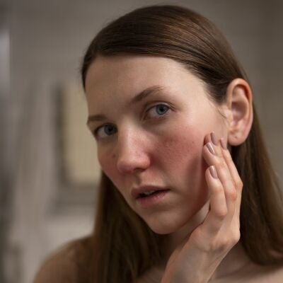 Mujer con irritaci&oacute;n en el rostro