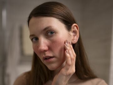 Mujer con irritaci&oacute;n en el rostro