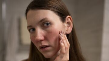 Mujer con irritaci&oacute;n en el rostro