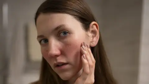 Mujer con irritación en el rostro Mujer con irritación en el rostro