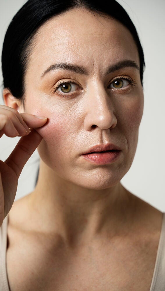 Mujer con irritación en el rostro