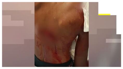 Brutales ataques entre inmigrantes en Ceuta
