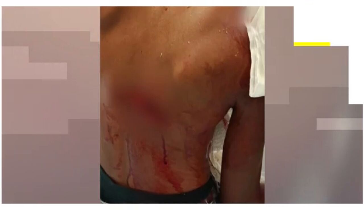 Brutales ataques entre inmigrantes en Ceuta
