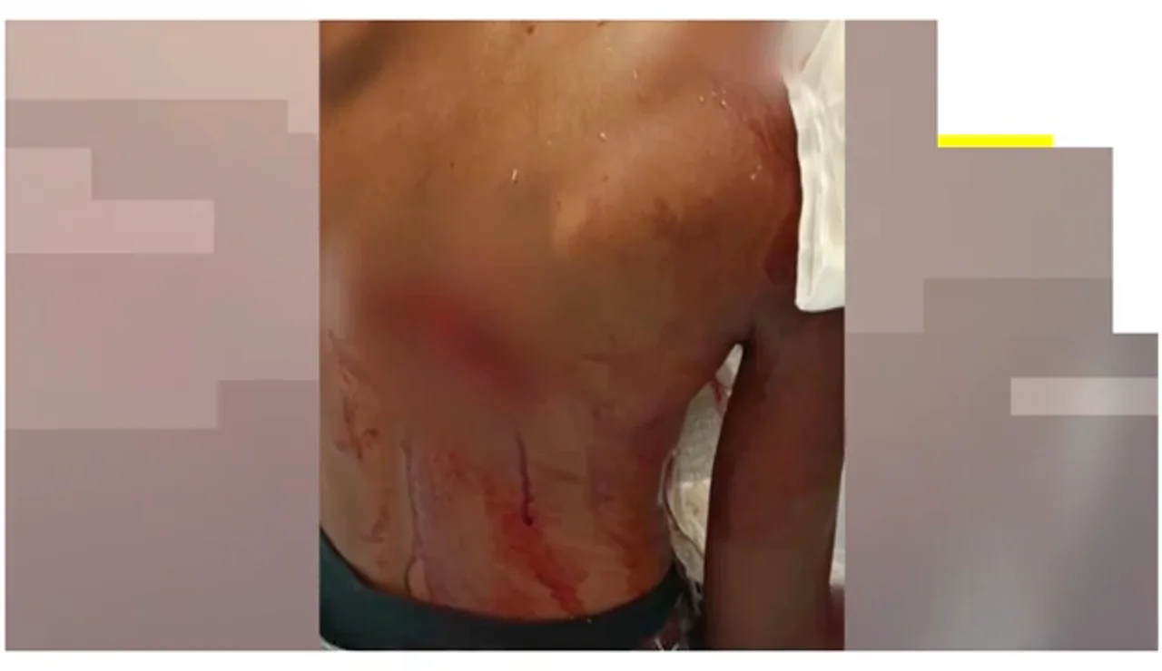 Brutales ataques entre inmigrantes en Ceuta