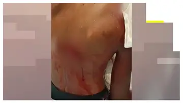 Brutales ataques entre inmigrantes en Ceuta Brutales ataques entre inmigrantes en Ceuta