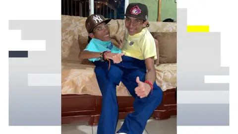 José Luis y José Armando Cevallos, los hermanos siameses José Luis y José Armando Cevallos, los hermanos siameses